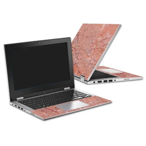 Pink Marble Inspiron i3147 11.6″ Skin